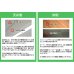 画像10: NHK「おはよう日本」まちかど情報室で紹介！エアーポール 2本タイプ・下向角度Mサイズ